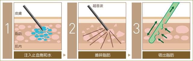 萊波亞