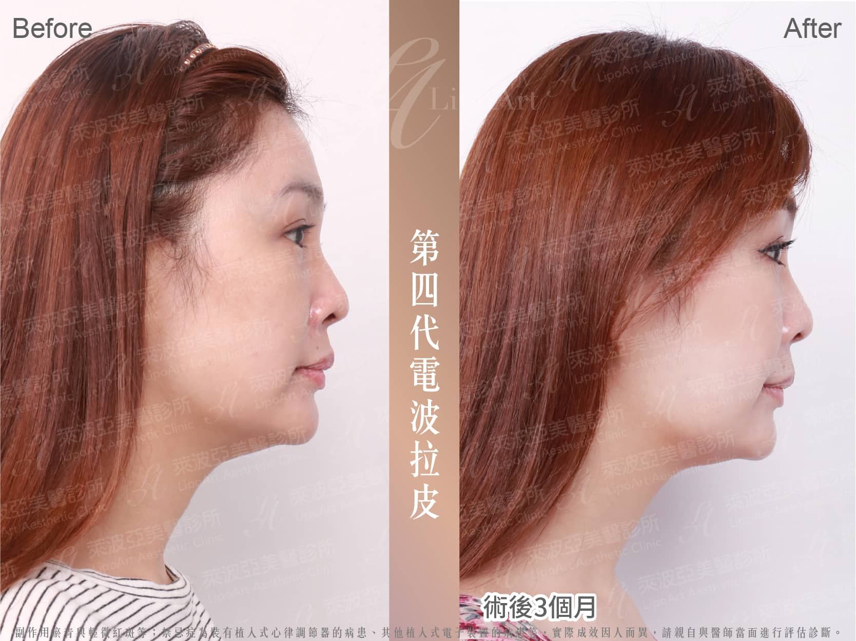 萊波亞 