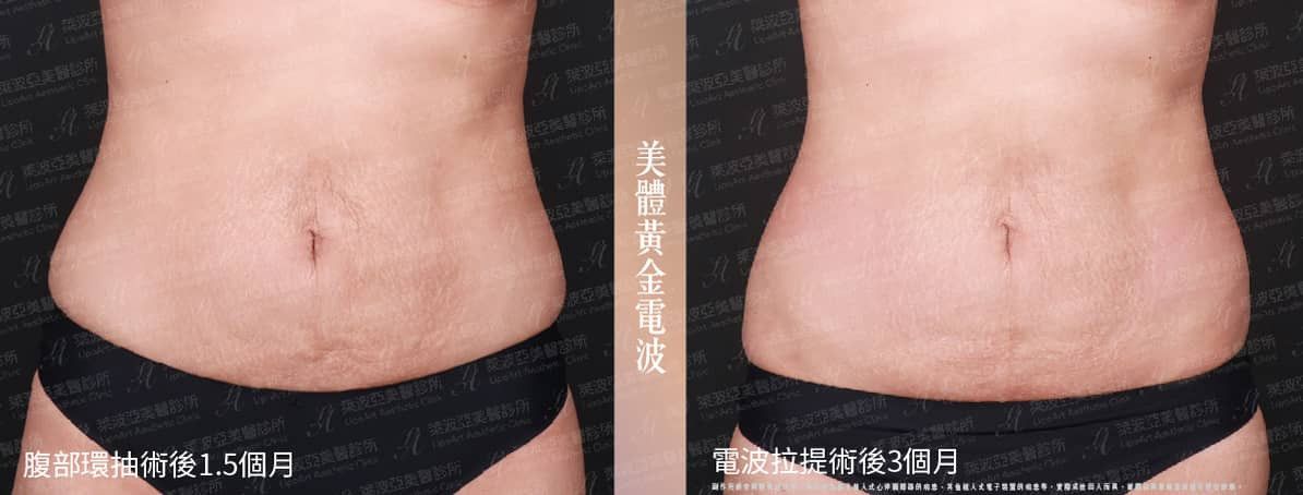 萊波亞