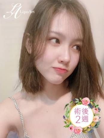 萊波亞
