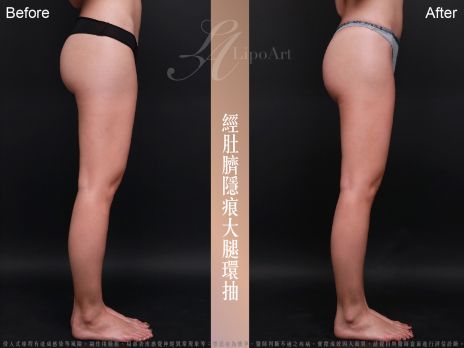 萊波亞 