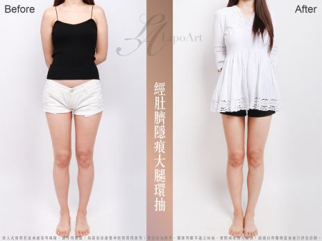 萊波亞 
