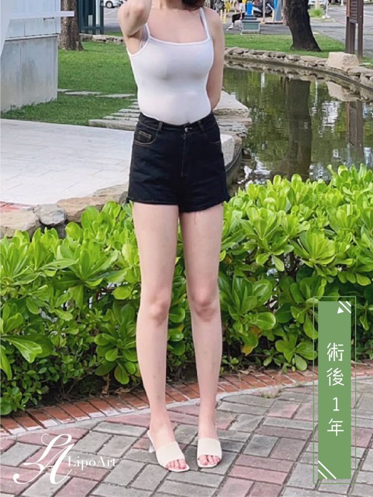 萊波亞