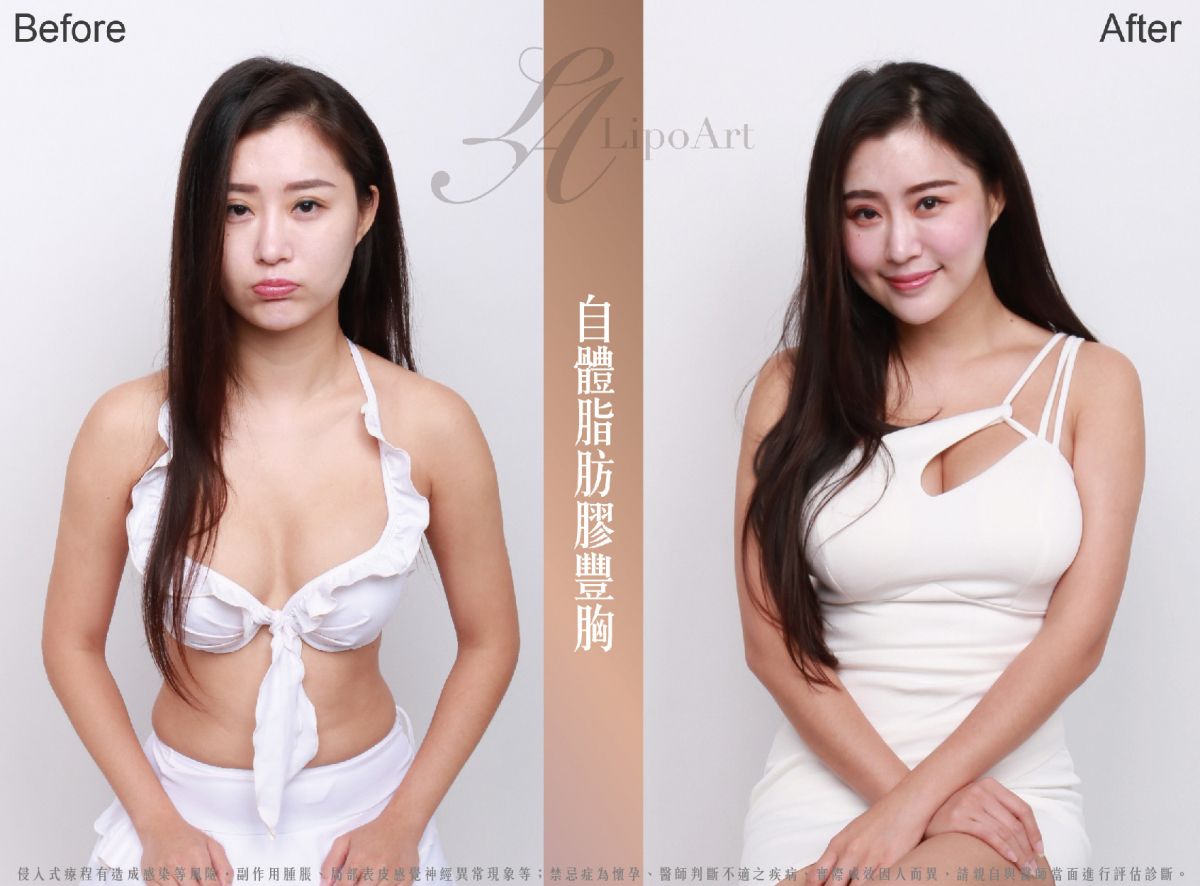 萊波亞