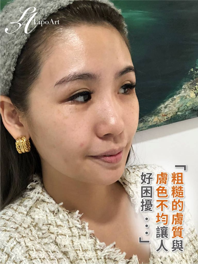 萊波亞