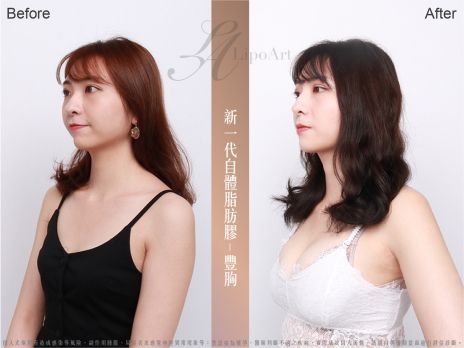 萊波亞 