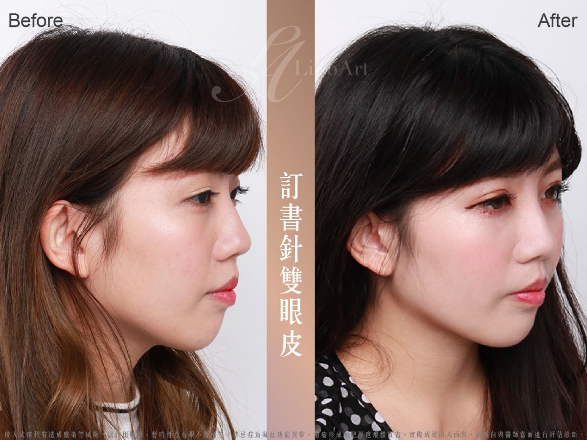 萊波亞