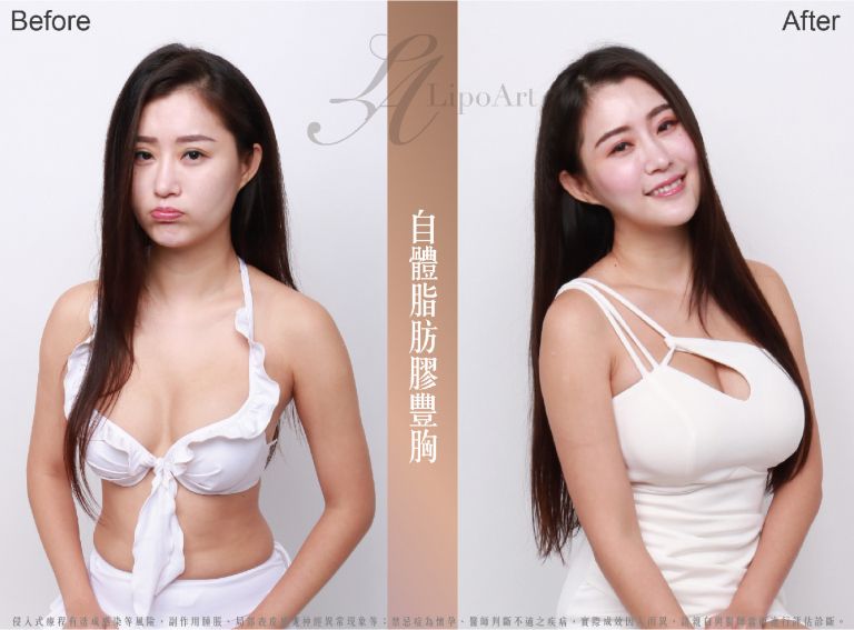 萊波亞
