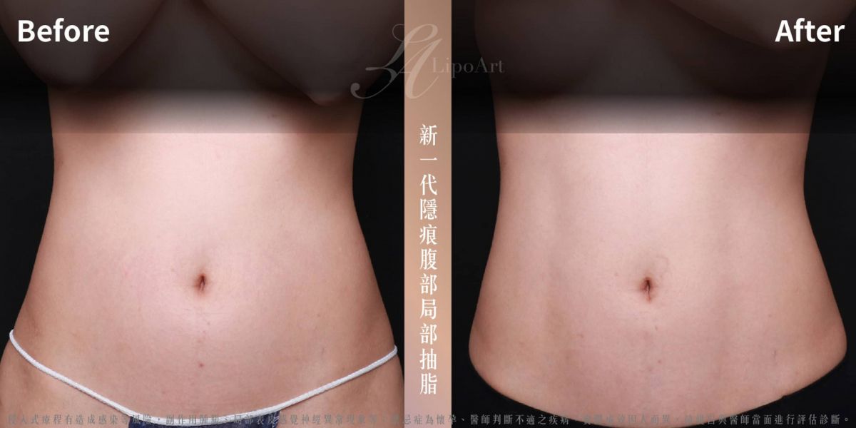 萊波亞