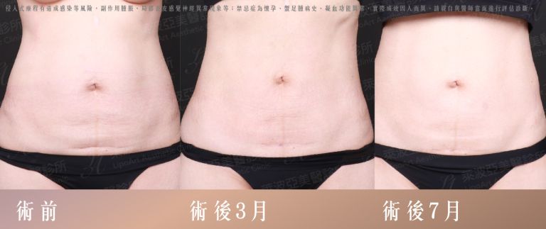 萊波亞