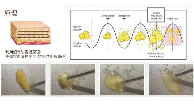 萊波亞
