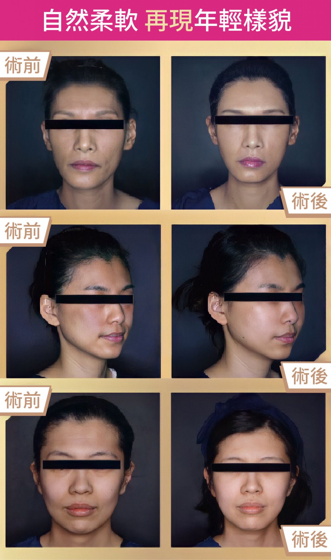 萊波亞