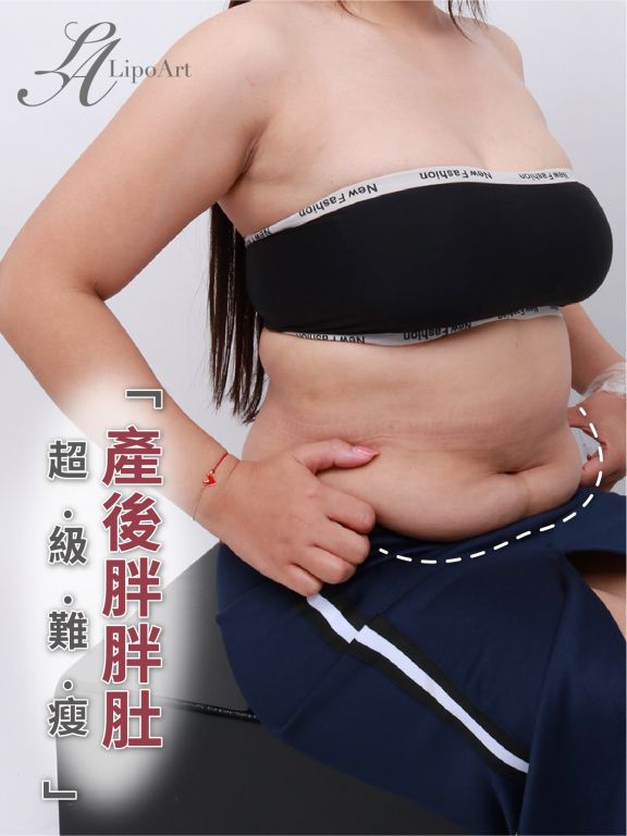 萊波亞