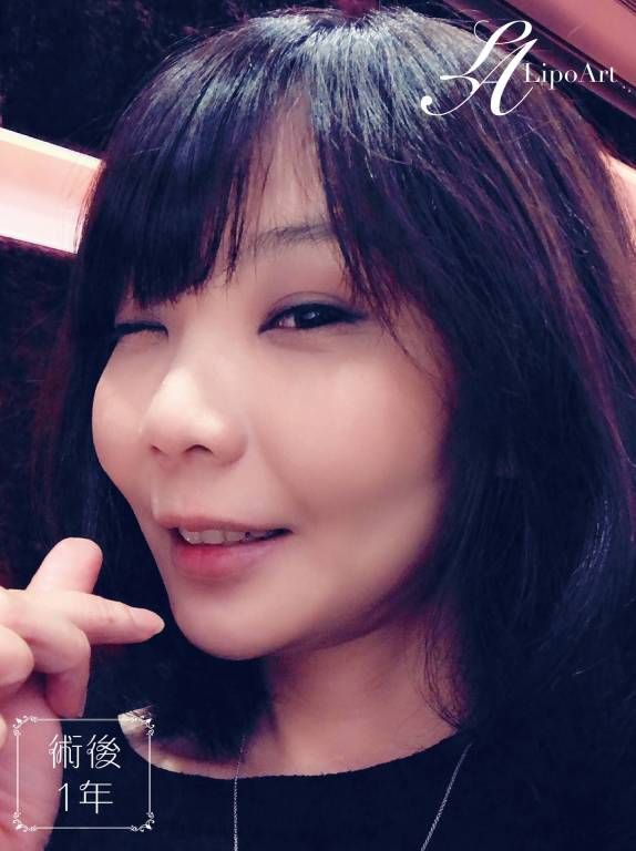 萊波亞