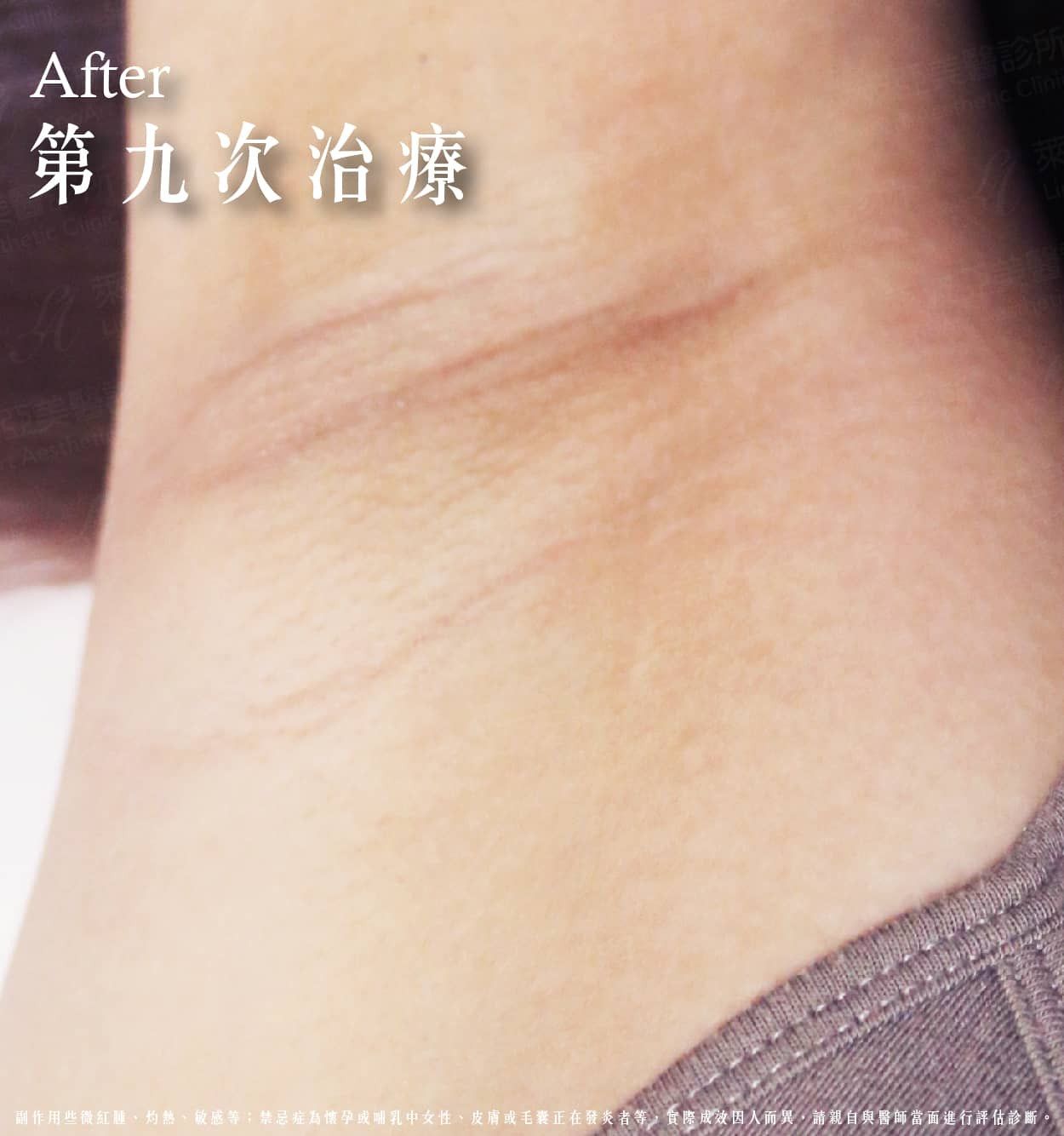 萊波亞