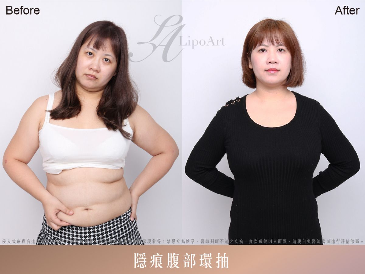 萊波亞