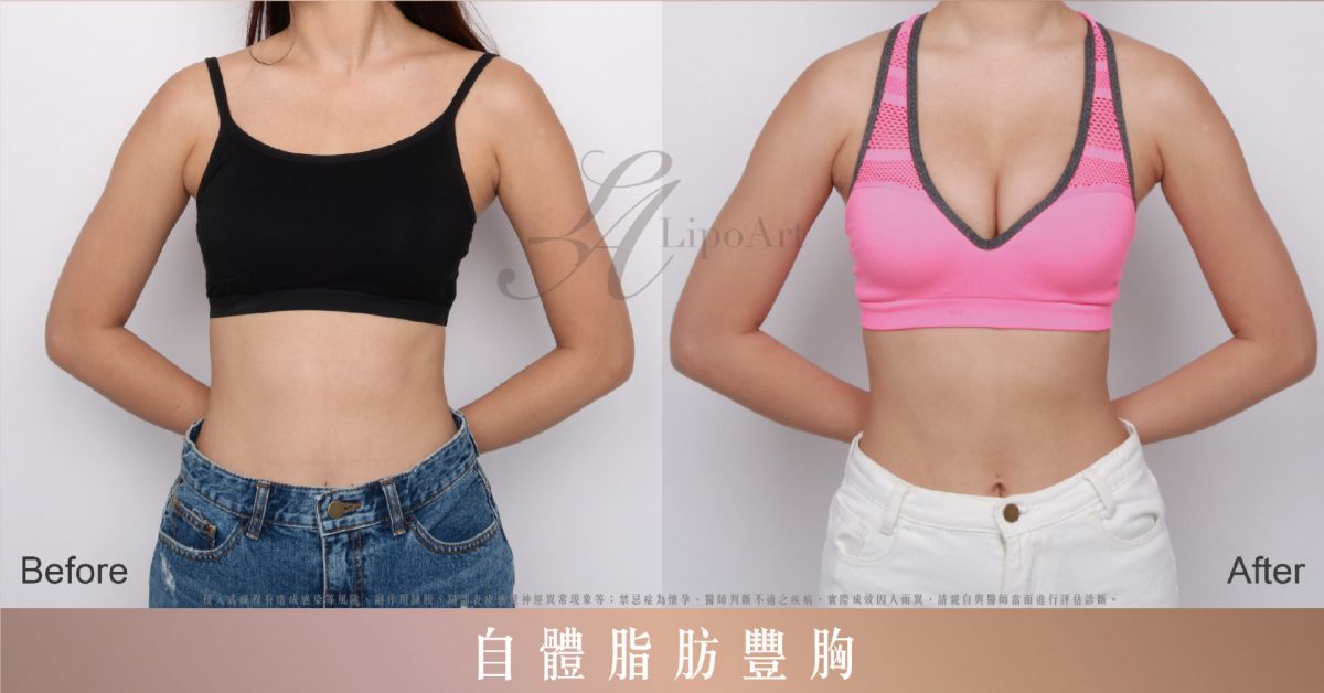 萊波亞