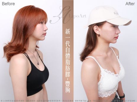 萊波亞 