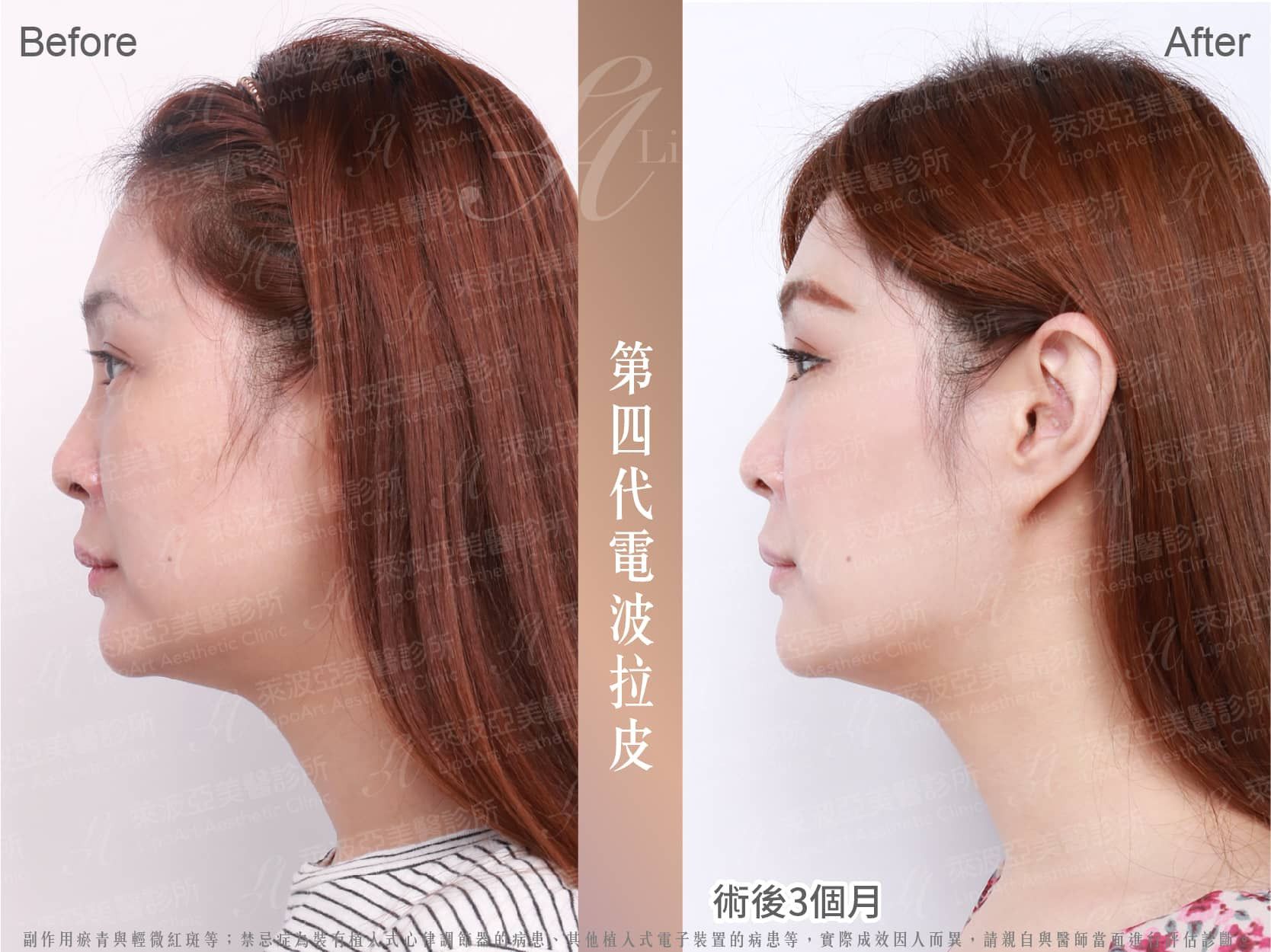 萊波亞 