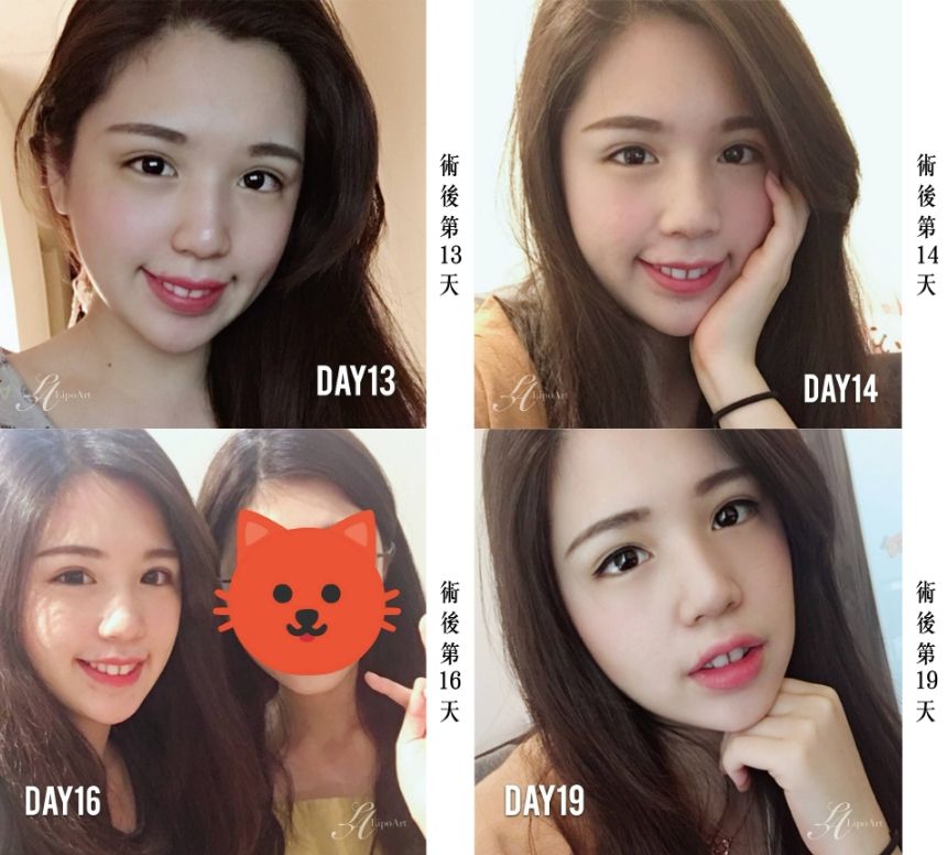 萊波亞