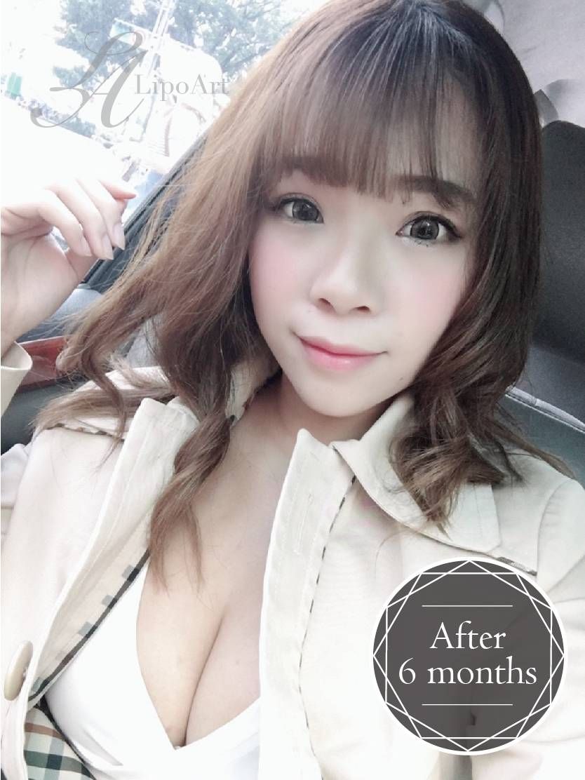 萊波亞