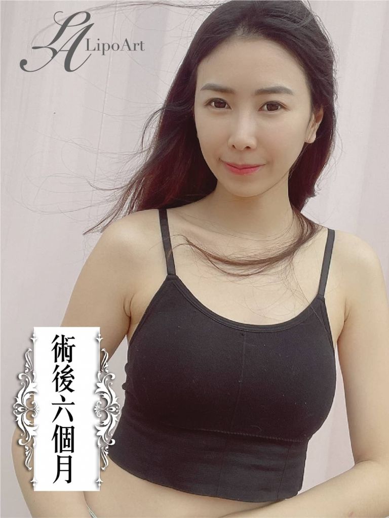 萊波亞
