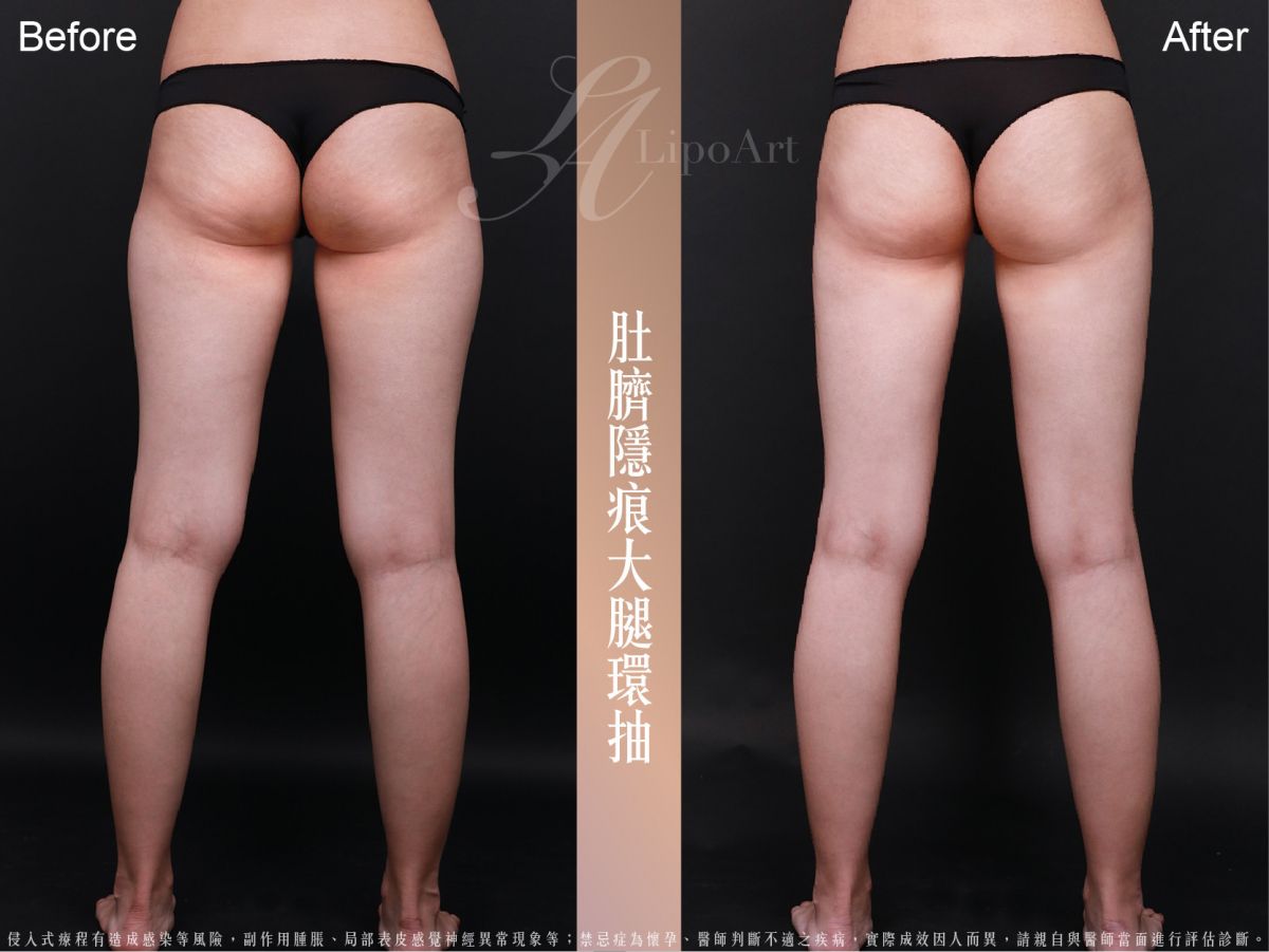 萊波亞