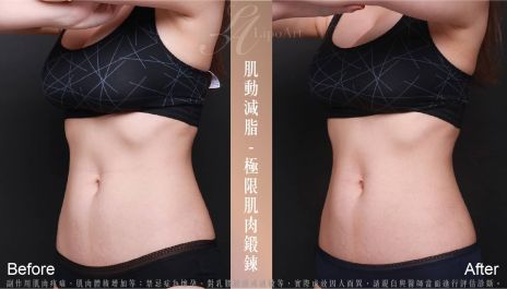 萊波亞 