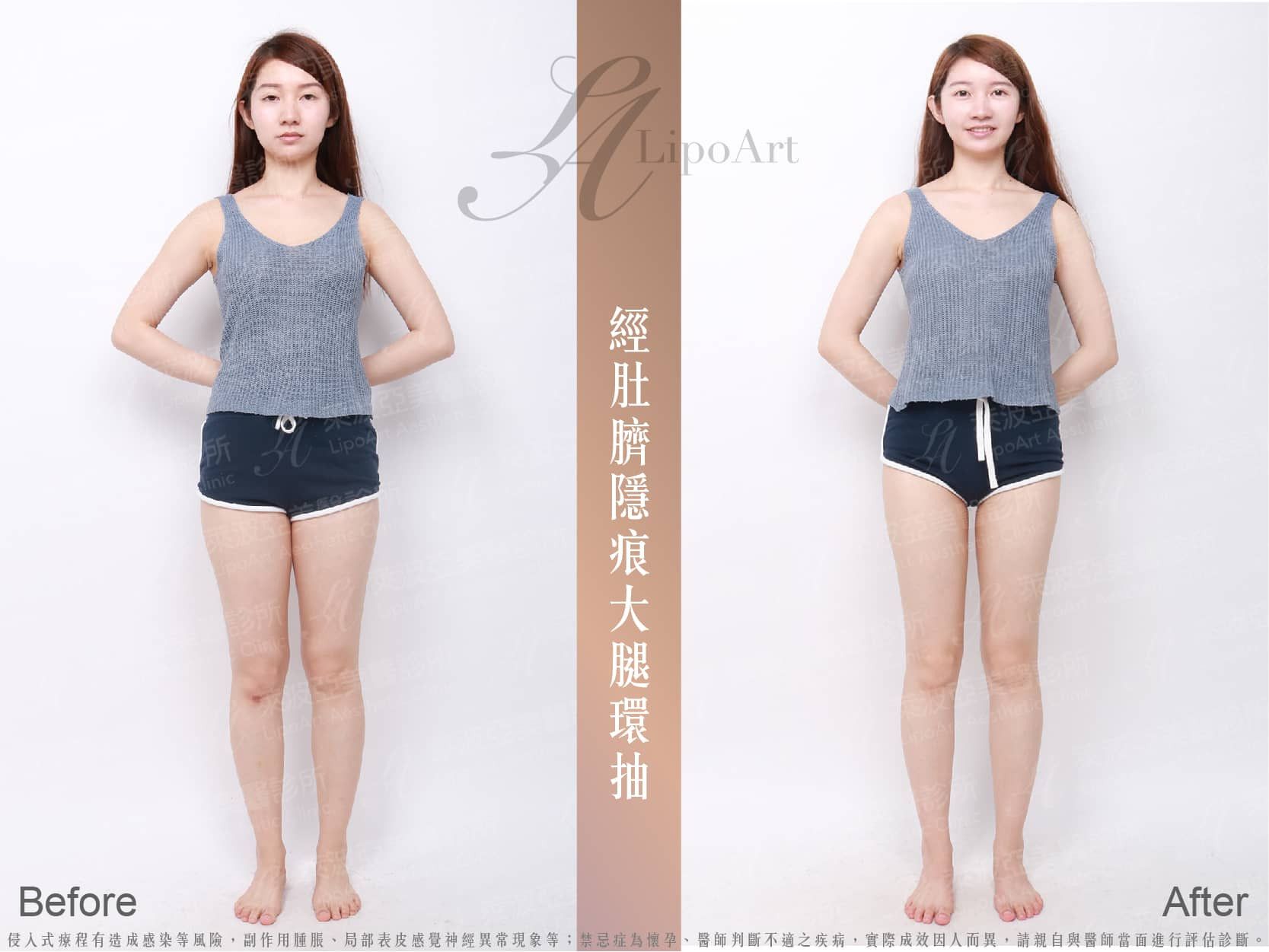 萊波亞