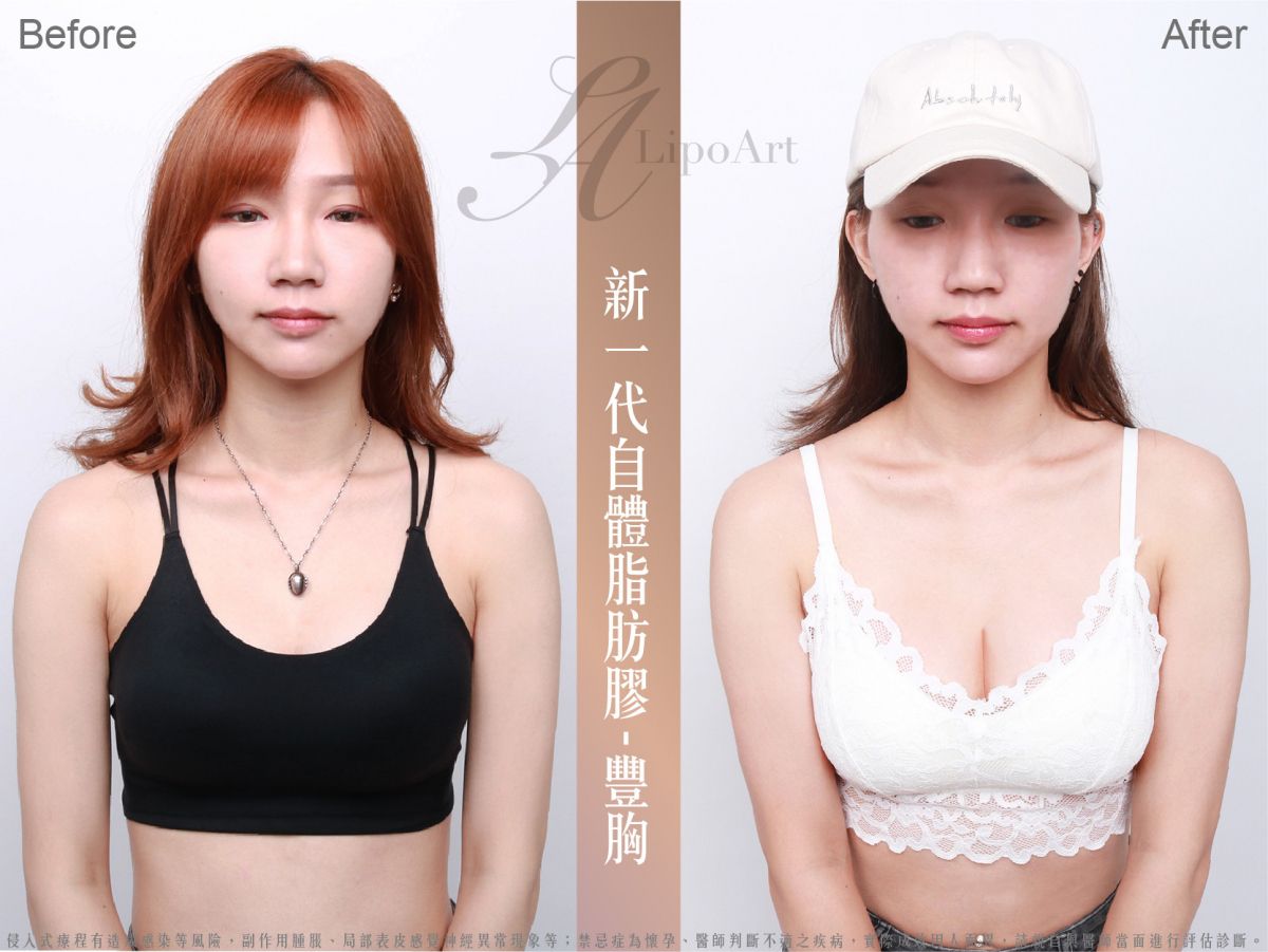 萊波亞