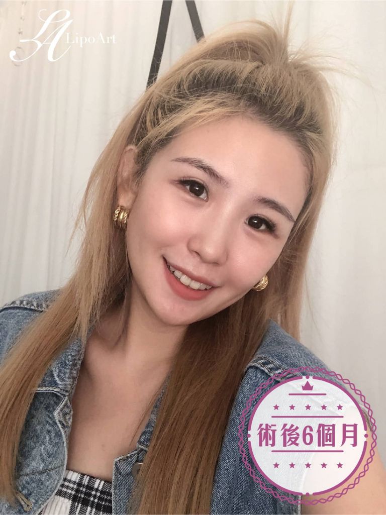 萊波亞