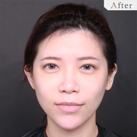 After