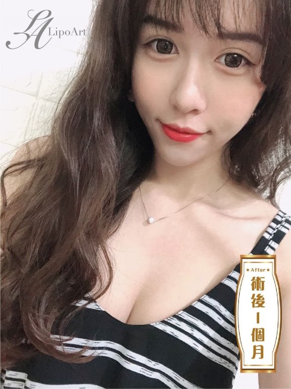 萊波亞