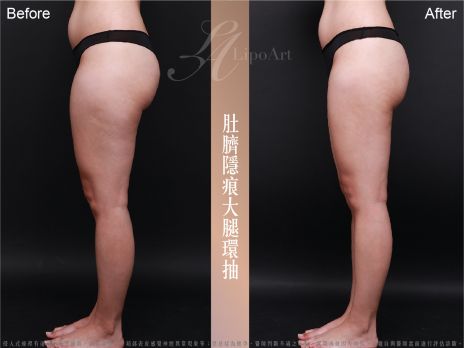 萊波亞 