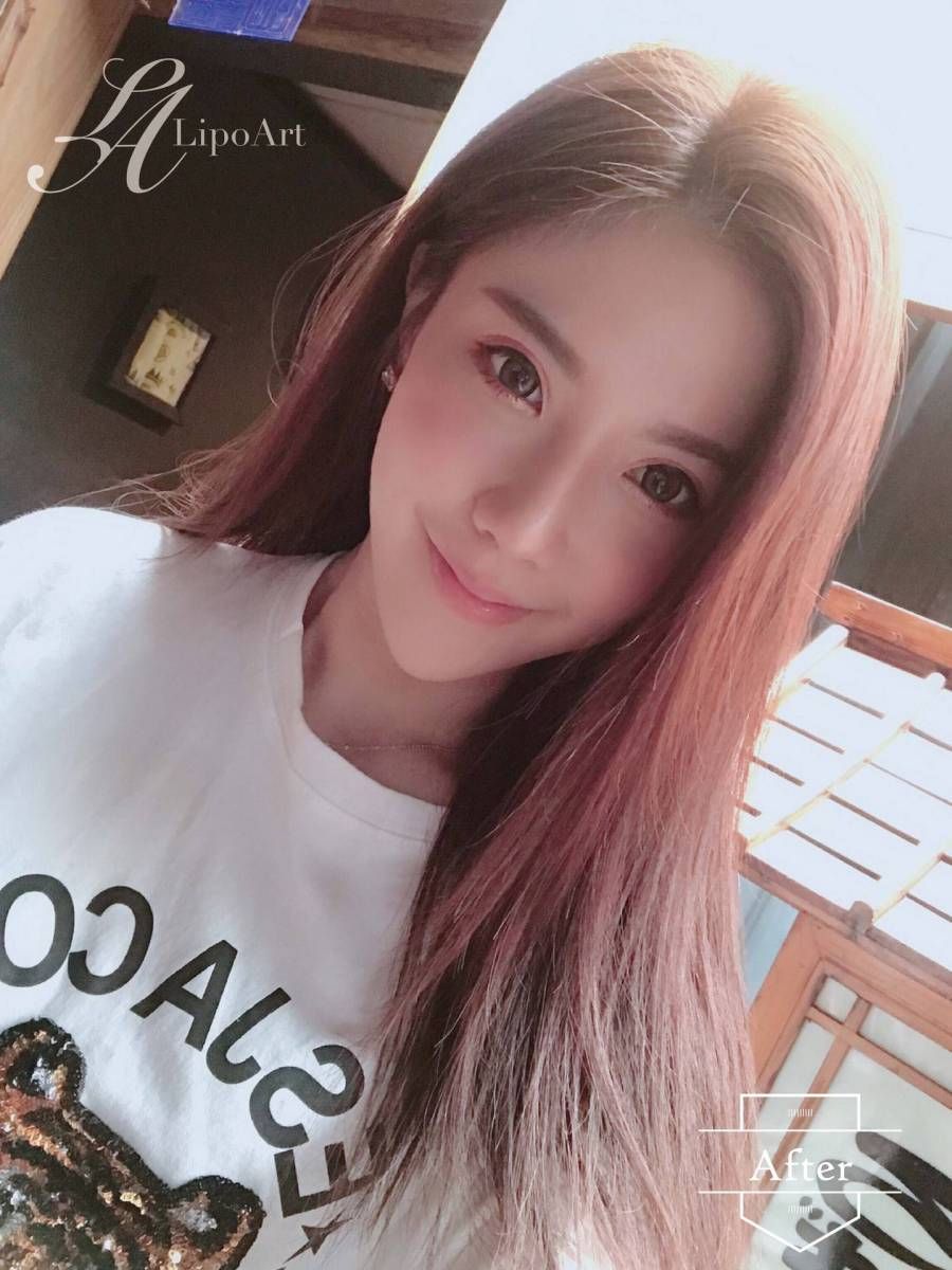 萊波亞