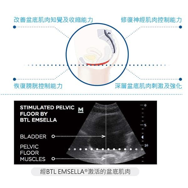 萊波亞