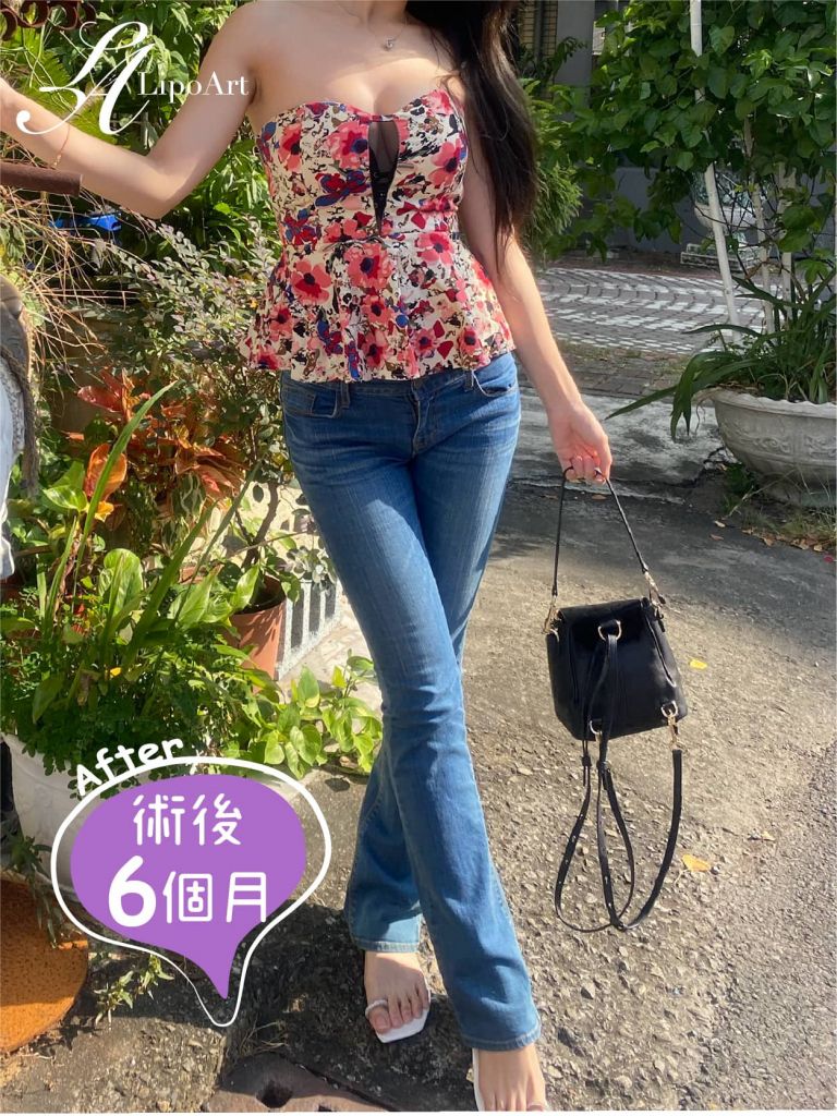 萊波亞