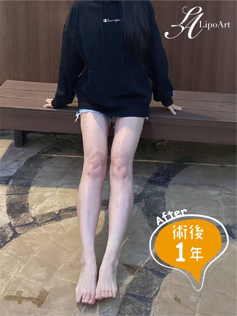 萊波亞