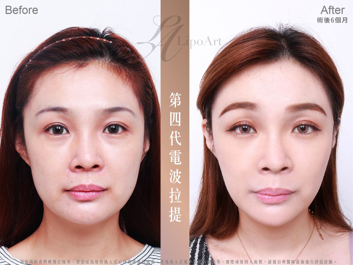 萊波亞