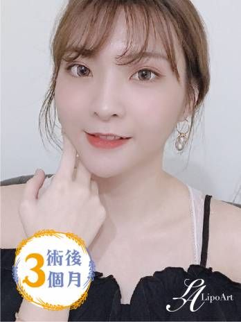 萊波亞