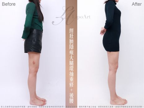 萊波亞 