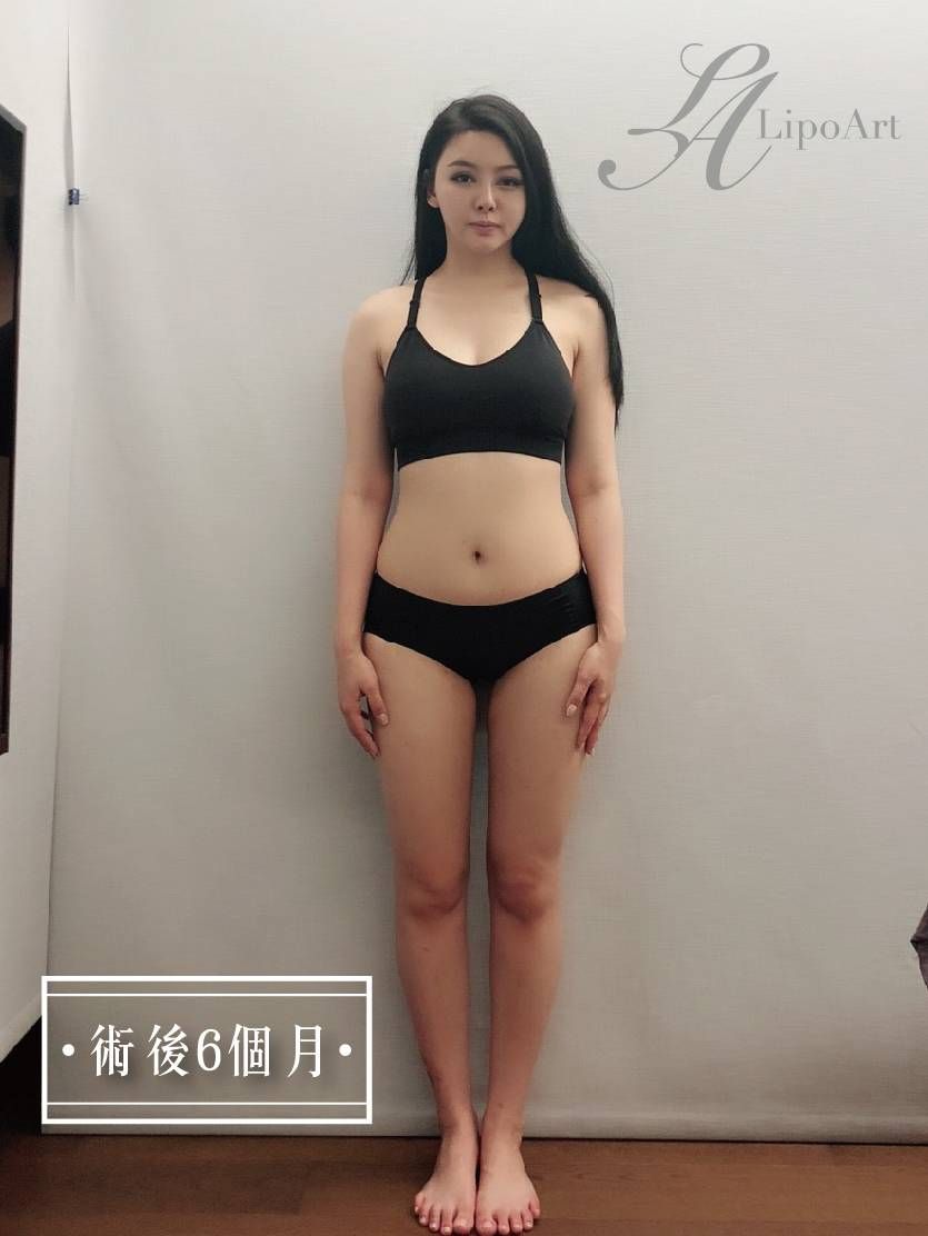 萊波亞 