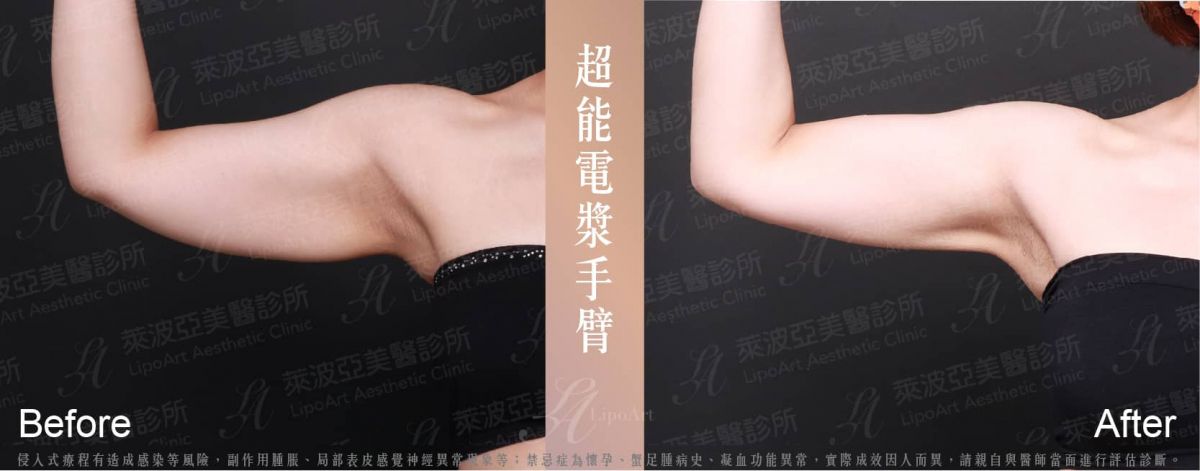 萊波亞