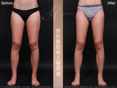 萊波亞 