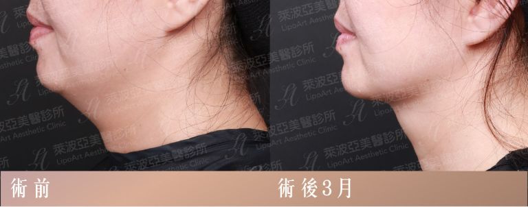 萊波亞