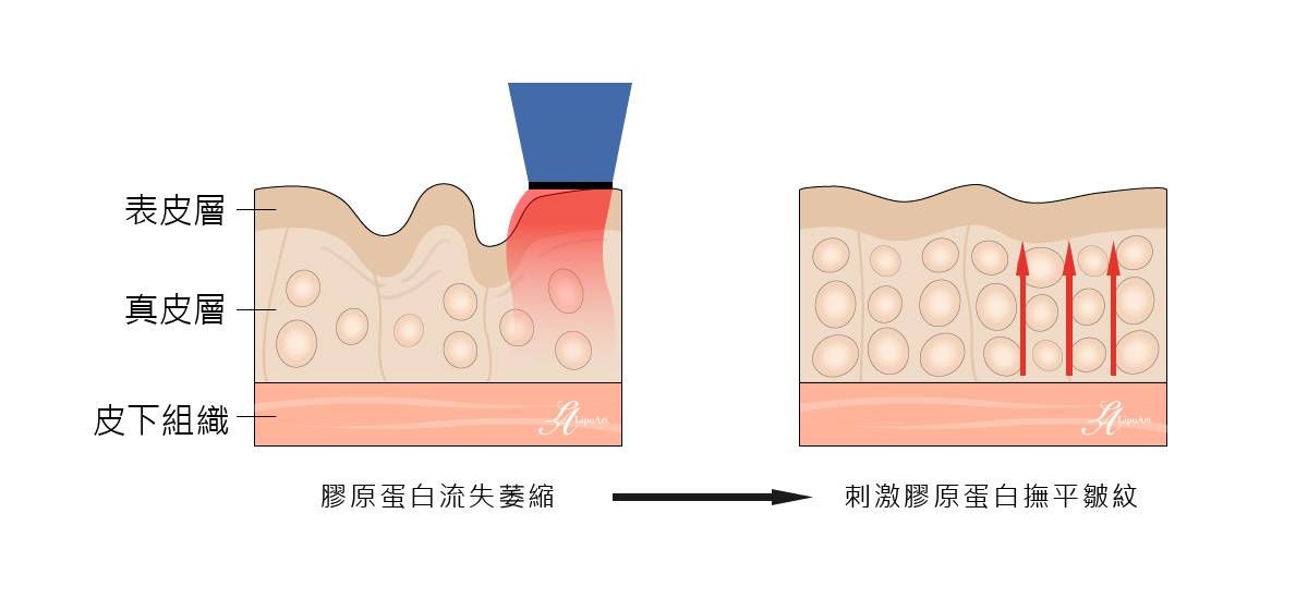萊波亞