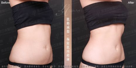 萊波亞