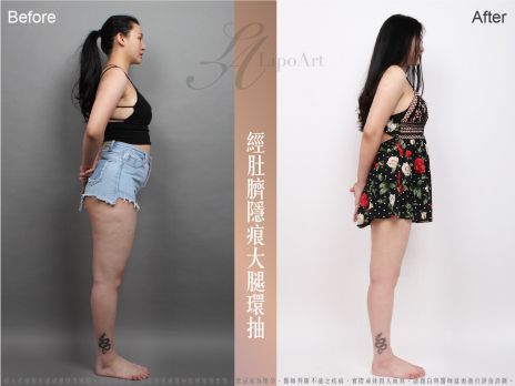 萊波亞 