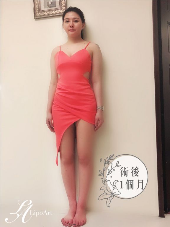 萊波亞