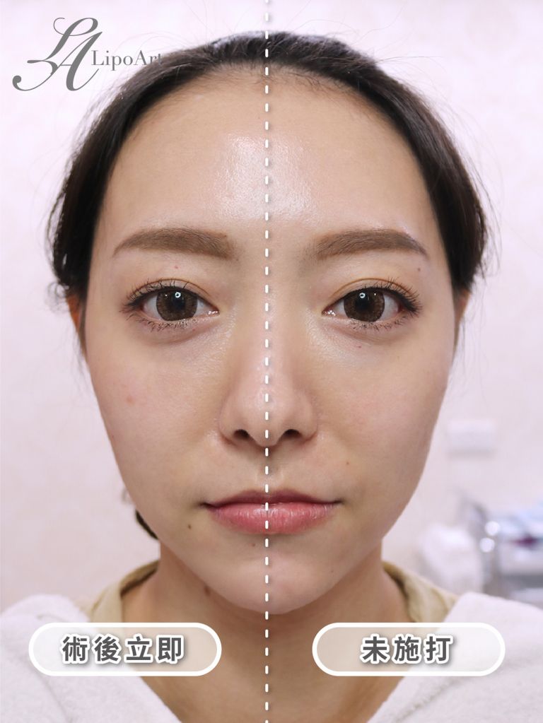 萊波亞